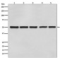 Anti-beta Tubulin Mouse Monoclonal Antibody